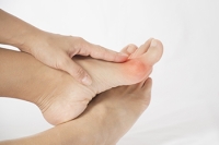 What Does a Bunion Look Like?