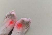 Treatment Options for Gout